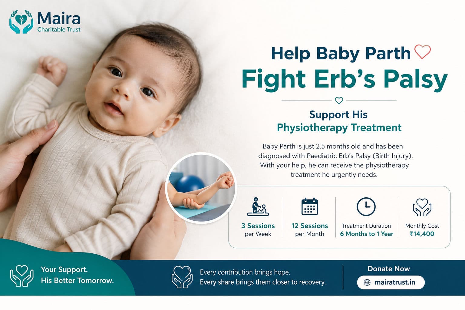 Help Baby Parth Fight Erb's Palsy – Support His Physiotherapy Treatment